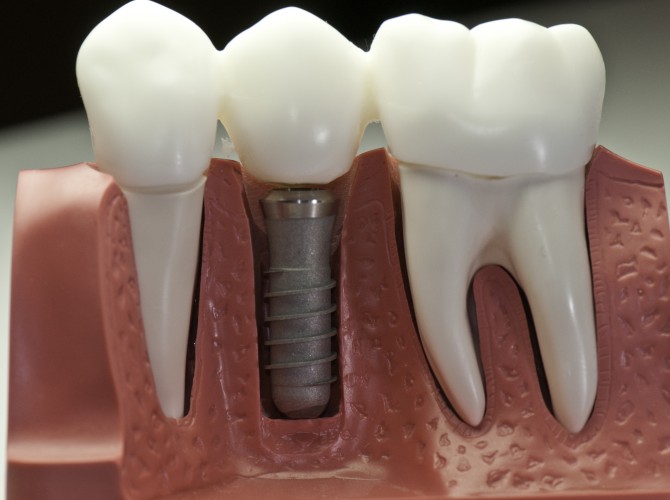 teeth health smile dentist
